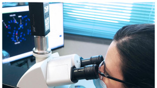 E' pronta la microscopia del futuro, non &egrave; invasiva