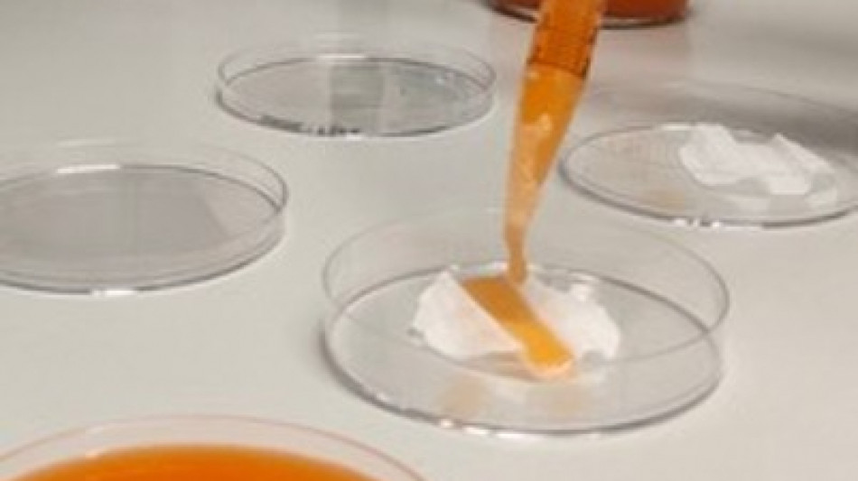 Dal giallo al rosso, i colori prodotti dai batteri sono 'economici e sostenibili'