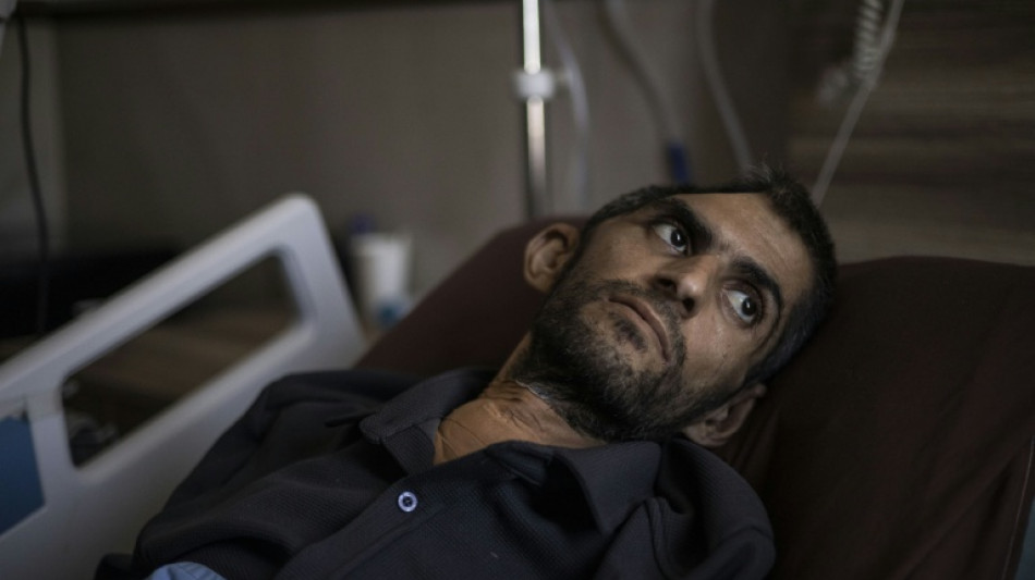 Israeli jails a 'graveyard,' says freed Palestinian journalist