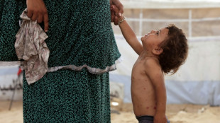 Catapora se espalha pelos superlotados acampamentos de deslocados em Gaza