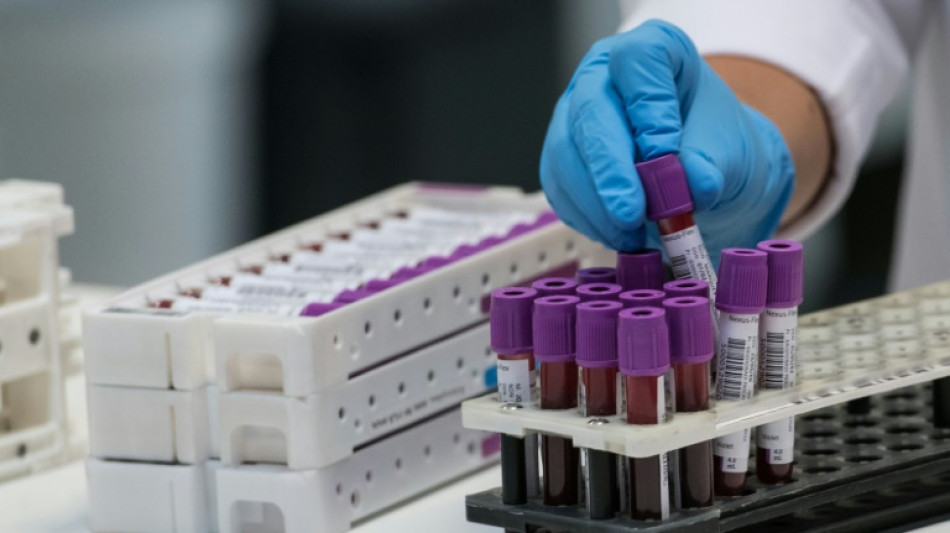 "Ce sera massif": les laboratoires d'analyses m&eacute;dicales en gr&egrave;ve pour quatre jours