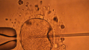 Un estudio apoya hipótesis de disminución mundial de concentración de espermatozoides