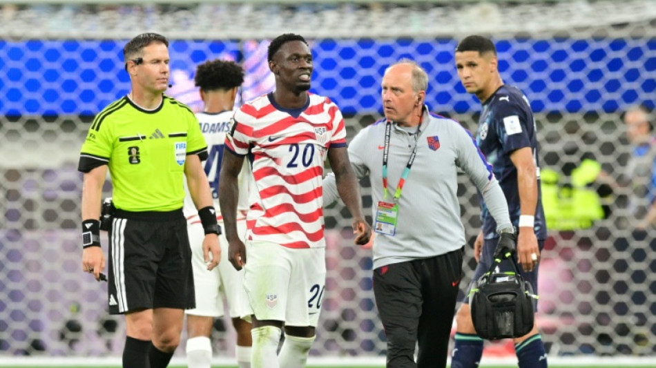 El caso Balogun no es el primero en el que la pol&iacute;tica entra en juego durante un Mundial