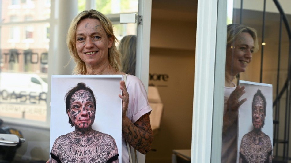 More than skin deep: Dutch abuse victims erase forced tattoos