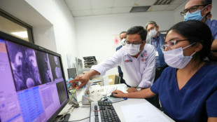 El Síndrome Guillain-Barré, el brote en Perú de una enfermedad poco común