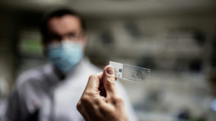 Une start-up veut &eacute;lucider les myst&egrave;res de survivants de cancers r&eacute;put&eacute;s incurables

