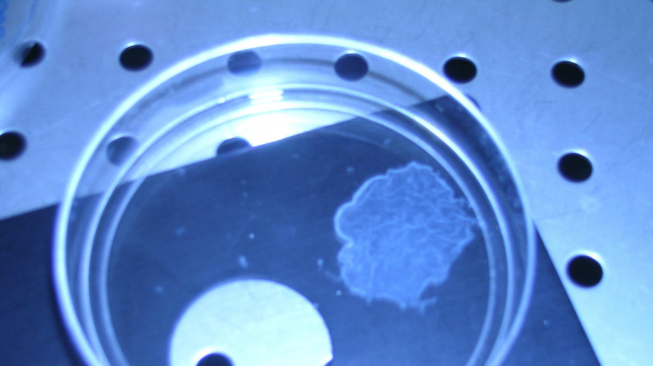 C'&egrave; un legame tra rigidit&agrave; dei tessuti e progressione dei tumori